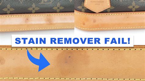 how to remove denim stain from louis vuitton|Louis Vuitton vachetta leather.